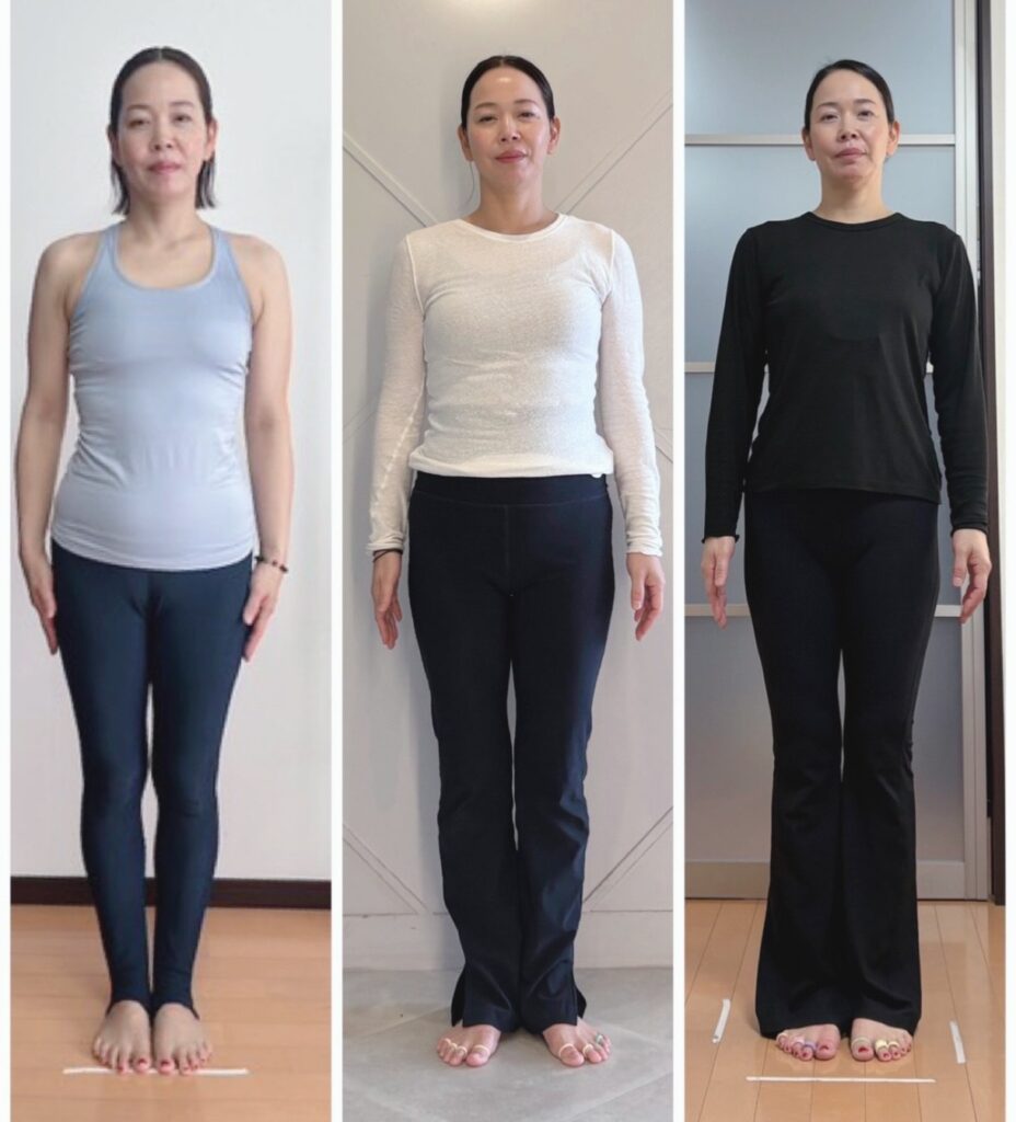 骨格ベクトレサロンwishawishのビフォーアフター写真
